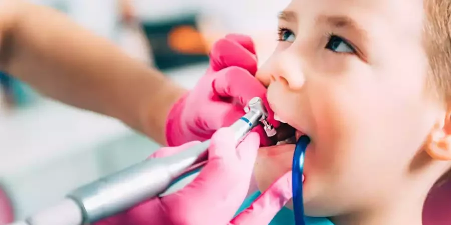 kids-sealants